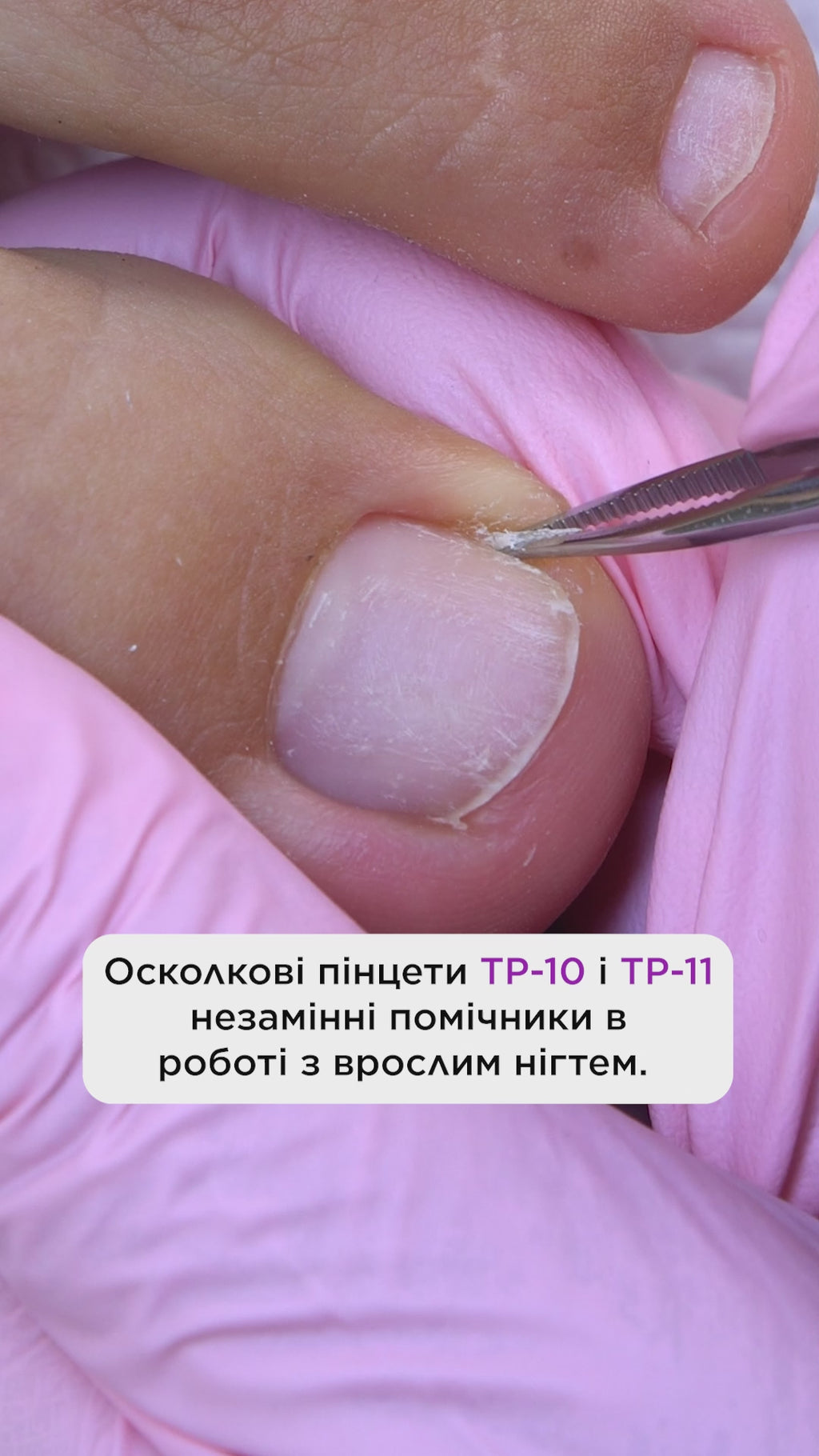 Пінцет осколковий PODO 10 STALEKS PRO TP-10